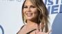 Chrissy Teigen Instagrams her stretch marks, which are a normal part of life