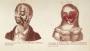 Gruesome treatments from medicine's murky past