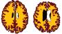 Being overweight 'ages people's brains'
